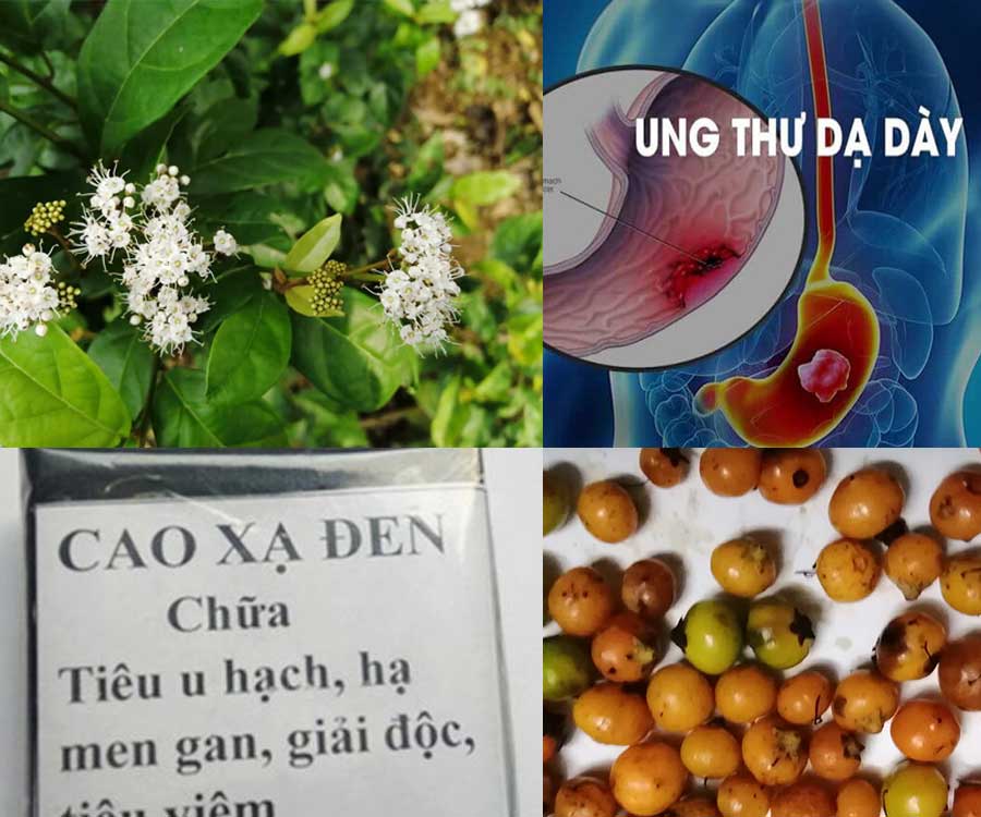 Bị ung thư Dạ Dày di căn sang Gan dùng cao xạ đen, hay thân lá xạ đen
