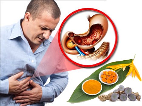 Bệnh đau bao tử Bệnh đau bao tử