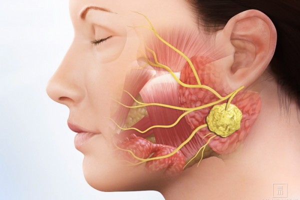 Ung thư tuyến nước bọt Ung thư tuyến nước bọt